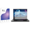 Blue Light Blocking Screen Protector for Gigabyte AORUS 15 2024.