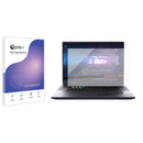 Blue Light Blocking Screen Protector for Gigabyte AORUS 16X 2024.